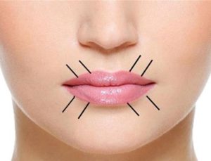 چینهای اطراف لب