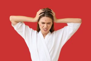 استرس آکنه